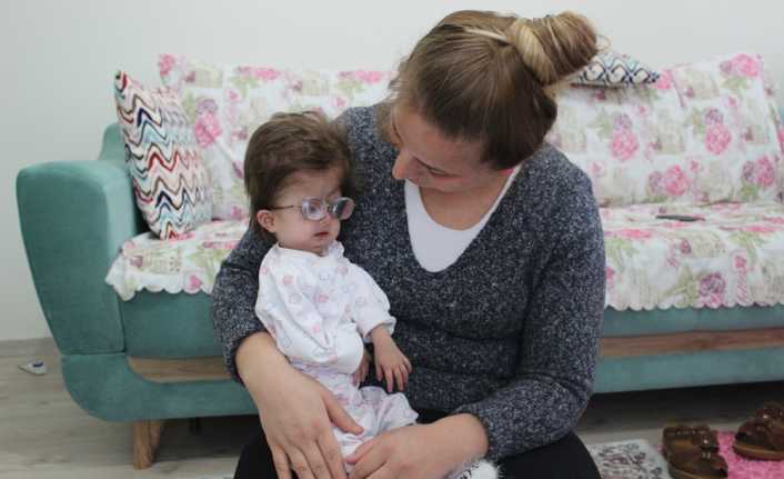 Dünyada ender rastlanan hastalıklardan Hallerman-Streiff Sendromlu olan Hira Hatice Gültekin,