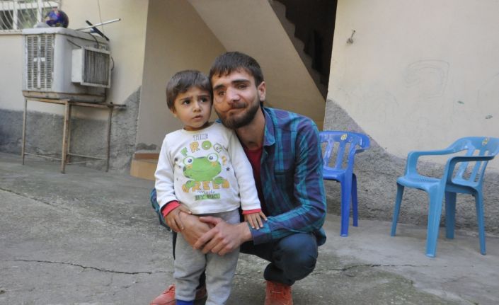 Batman’da geçirdiği kaza sonucu yüzünün yarısı zarar gören Mehmet Vefaddin