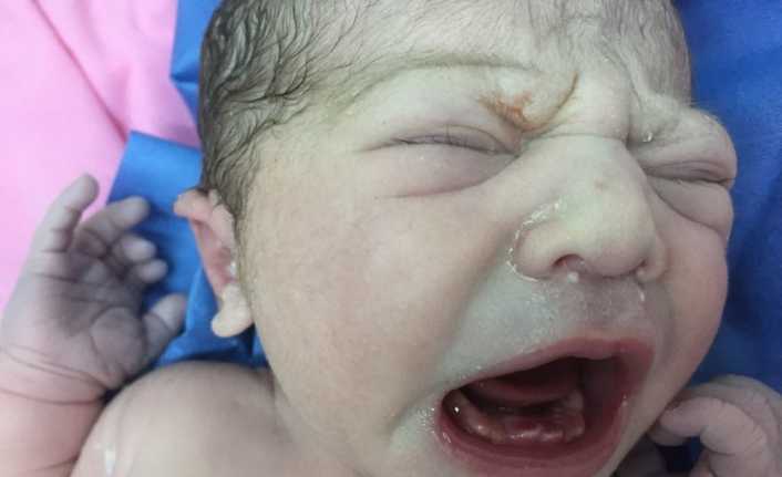 Amasya’nın Merzifon ilçesinde dünyaya gelen bebeğin 9 dişinin olması herkesi