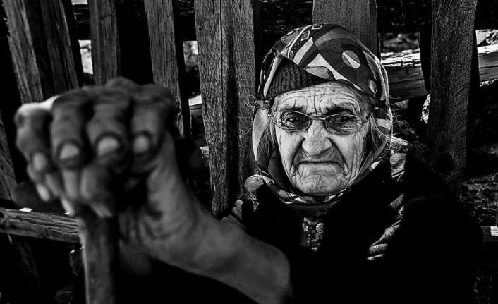 Dr. Ata Nejat Ertek, açık tenlilerin cildinin daha çabuk yaşlandığını