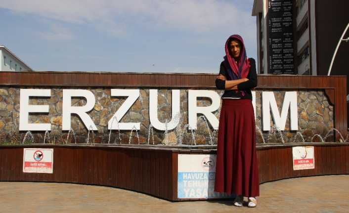Erzurum’da yaşayan akromegali hastası Serap Demir, iddiasına göre, boyunun 2
