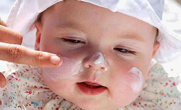 Ultraviyole ışınlarına fazla maruz kalan çocuklarda güneş yanıkları oluşabileceğine dikkat