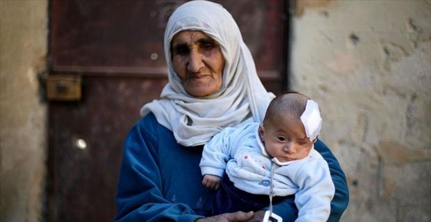 Esed rejiminin saldırısında annesini ve sol gözünü kaybeden, Doğu Guta'nın