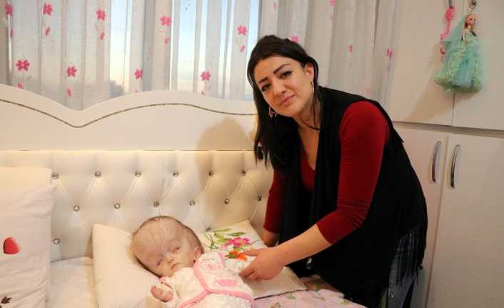 Kayseri’de 6 aylıkken hidrosefali tanısı konulan 15 aylık Dilara Semina’nın