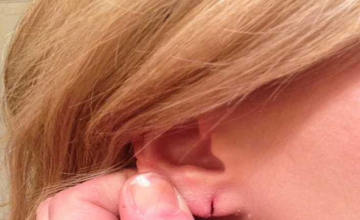 Piercingin ciddi sağlık sorunları ortaya çıkarabileceğini belirten Estetik ve Plastik