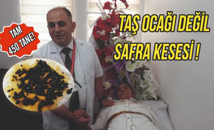 Erzincan'da, karın ağrısı şikayeti hastaneye başvuran Zeynep Dağ, (74) safra