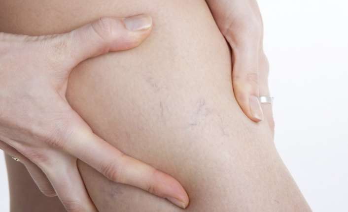 Dermatoloji Uzmanı Dr. Fulya Tezel,  “Vücutta kirli kan ve