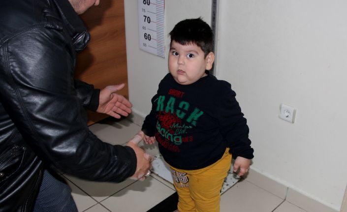 Leptin hormonu eksikliği nedeniyle sürekli kilo alan ve 2,5 yaşında