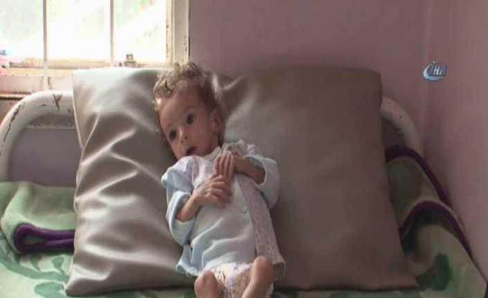 Yemen’de insanların yaşamını tehdit eden ekonomik kriz ve savaş nedeniyle